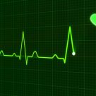 Ce este o electrocardiograma de stres si efort?